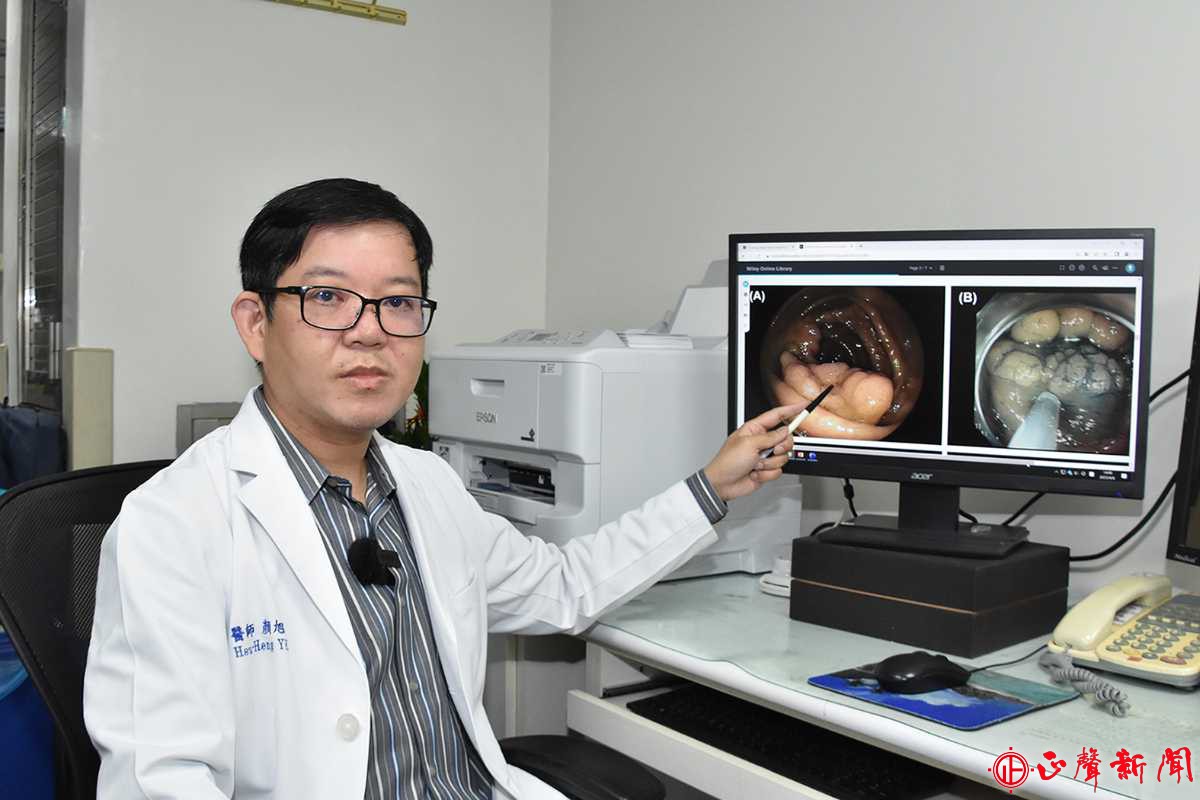 顏旭亨醫師表示，實行「內視鏡黏膜下剝離術」之前，首先必須要接受內視鏡的評估。(記者梁添義攝)-正聲新聞